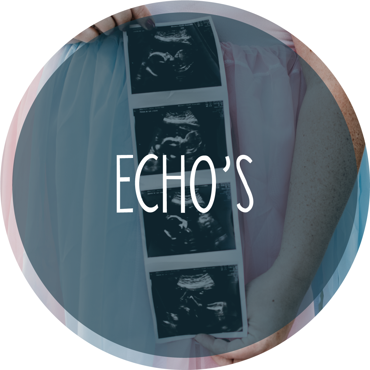 Echo cirkel